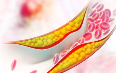 Cholesterol a Schüsslerovy soli