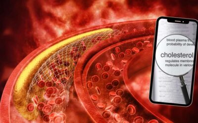 Homeopatika u vysokého cholesterolu