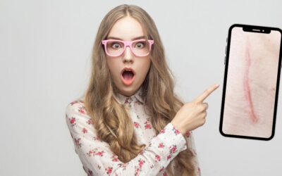 Jizvy a homeopatie – vyberte si z nejčastějších homeopatik