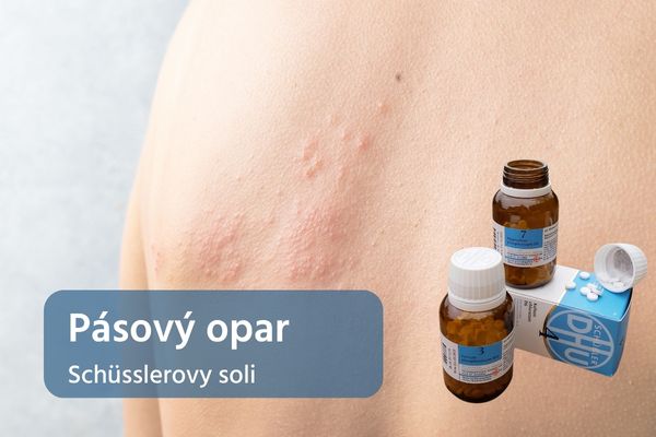 Pásový opar: Schüsslerovy soli, léčba a přírodní podpora